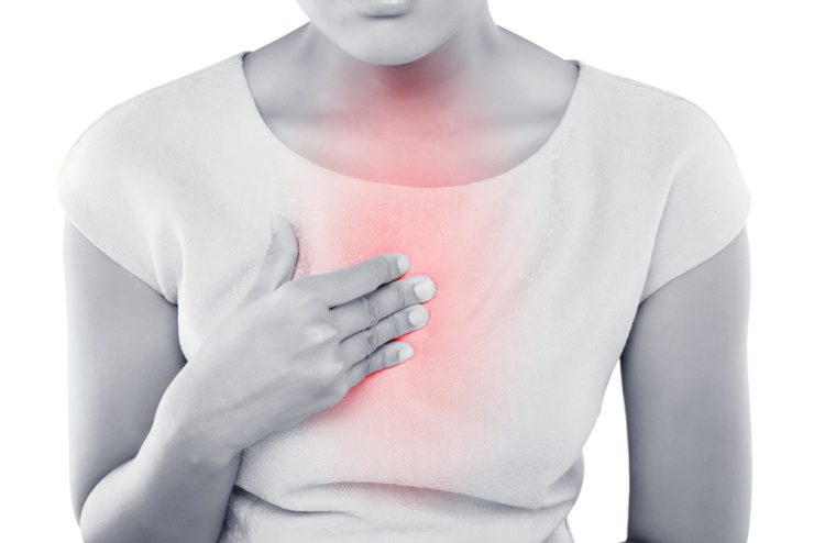 Woman with heartburn